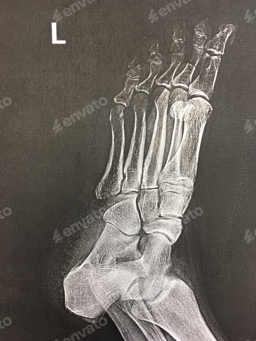Preview: X-ray