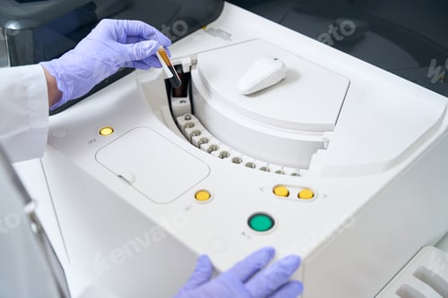 Preview: Laboratory employee sends a blood sample to an immunochemiluminescent analyzer