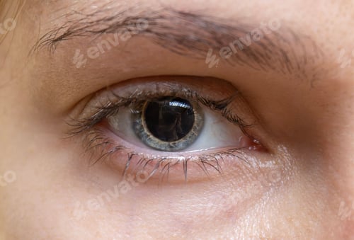 Preview: Dilated pupil of a woman's eye