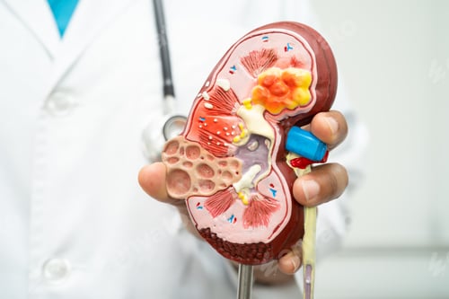 Preview: Cardiovascular disease CVD, Asian doctor holding human anatomy model for learn