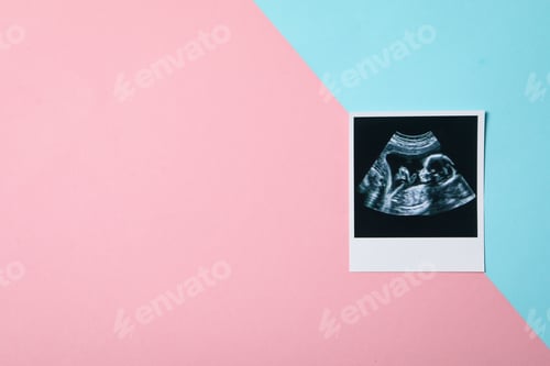 Preview: Concept of pregnancy and maternity, space for text