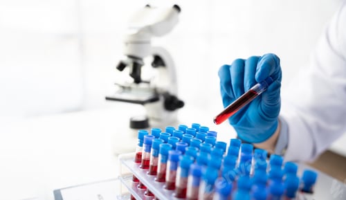 Preview: Doctor hand taking a blood sample tube from a rack with machines of analysis in the lab background