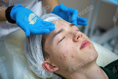 Preview: A young Caucasian teenage boy has a cosmetologist cleaning his face. A dermatologist treats acne on