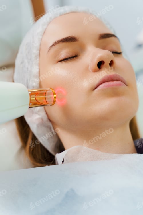 Preview: Painless rosacea laser therapy by dermatologist, IPL facial vessel correction