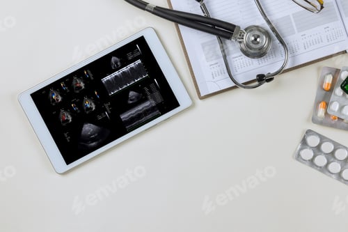 Preview: There is a doctor on the digital tablet who checks the results of echocardiography ultrasound in