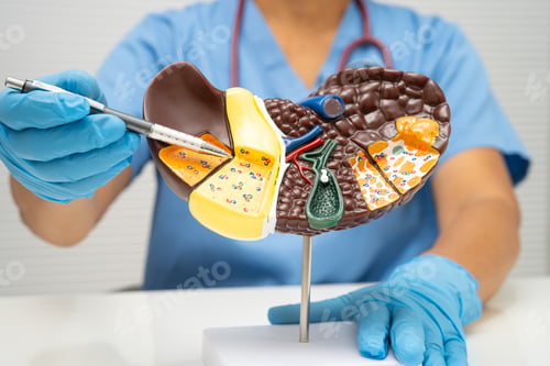Preview: Cirrhosis, Liver cancer, fatty liver, Asian woman with liver human anatomy model.