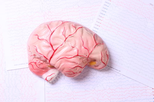 Preview: Human brain model on brain waves from electroenchalography