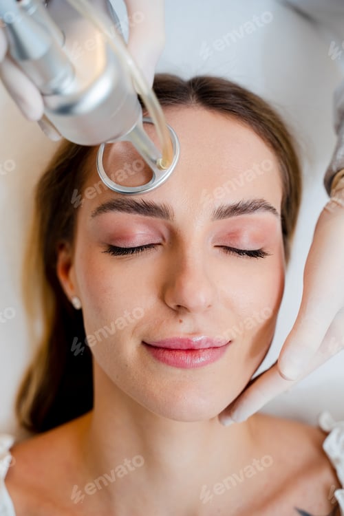 Preview: Professional facial CO2 laser procedure to remove wrinkles and scars.