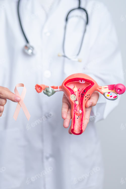 Preview: Doctor holding Peach ribbon with Uterus and Ovaries model for September Uterine Cancer Awareness