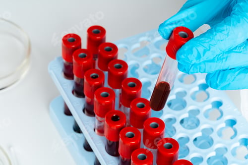 Preview: Doctor's hands in blue gloves keep test tube with a blood