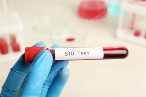 Preview: Scientist holding tube with blood sample and label STD Test on blurred background, closeup