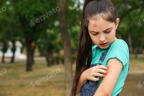 Preview: Girl scratching arm with insect bites in park. Space for text