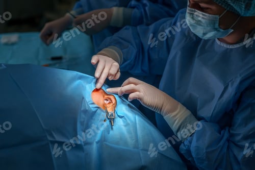 Preview: Woman doctor preparing for eye surgery. Ophthalmological clinic.