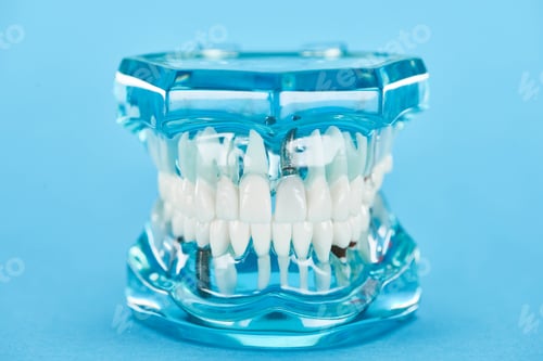 Preview: selective focus of teeth model with healthy jaw and white teeth on blue