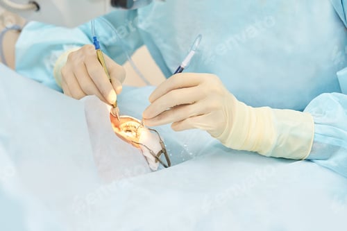 Preview: Ophthalmology laser microscope operation. Doctor in clinic. Patient treatment
