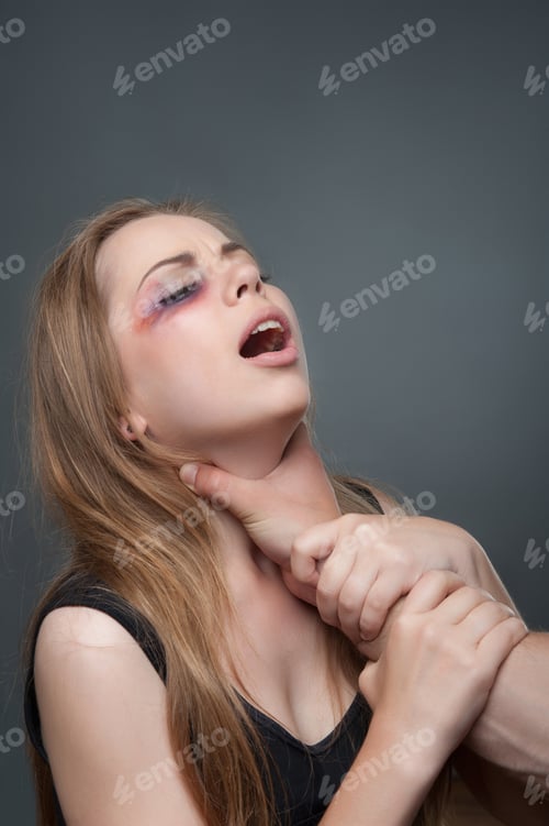 Preview: Poor Young Woman With The Black Eye Standing Aside To Us Suffering From The Pain. Her Husband Wants