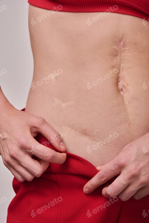 Vista previa: Body positive woman with scar on body