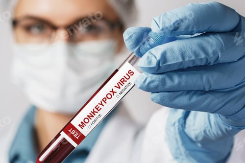 Preview: Female nurse with vacutainer with monkeypox blood sample for test