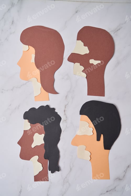 Preview: Silhouette of multiethnic people with vitiligo, skin condition. Made with paper craft.