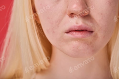 Preview: Female face with clean skin