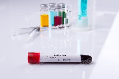 Preview: Test tube with coronavirus positive result.