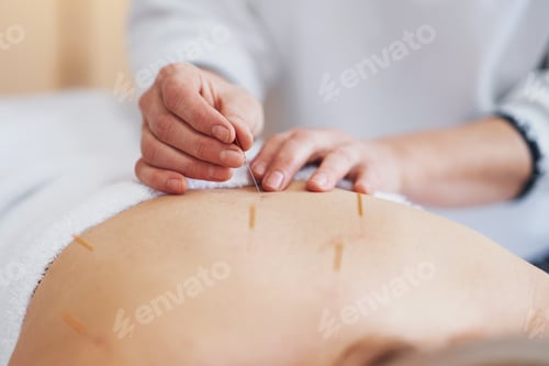 Preview: A acupuncture needle therapy in the studio