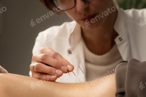 Preview: Acupunturist treating patient chronic back pain