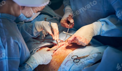 Preview: Surgery in Progress with Skilled Medical Team