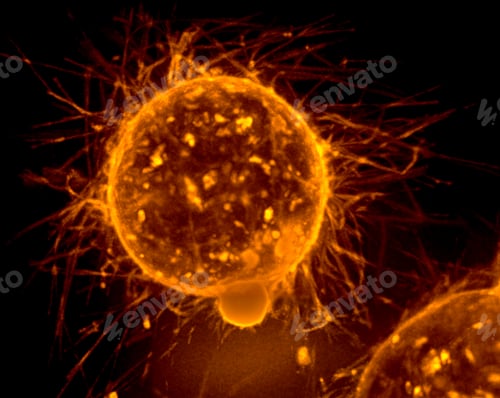 Preview: Epifluorescence microscopy of microtentacles on the surface of breast tumor cell