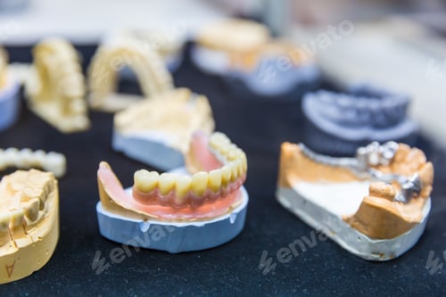 Preview: Denture treatment, dental implants closeup