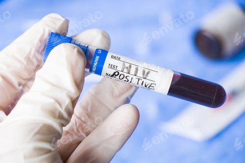 Preview: Selective focus of a doctor holding an HIV tube test in the laboratory