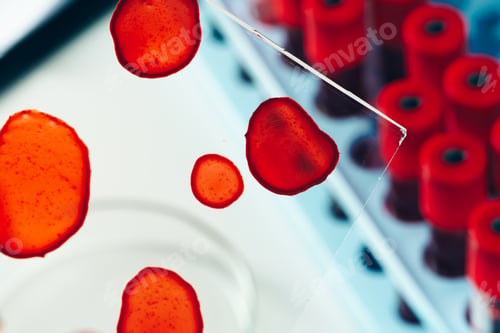 Preview: Medical equipment for blood test close up