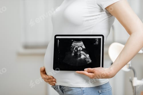 Preview: Pregnant woman with ultrasound scan of her baby