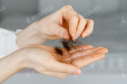 Preview: hair loss problem on hand