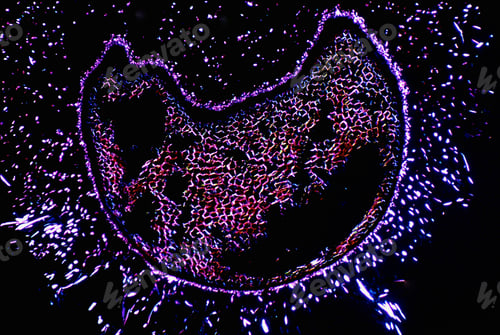 Preview: Human colonic specimen