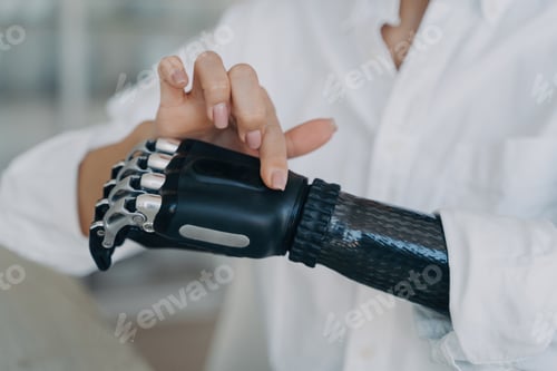 Preview: Hands of handicapped girl. Cyber prosthesis hand has processor chip, software and buttons.