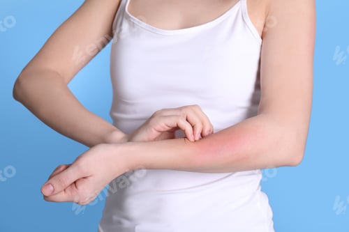 Preview: Woman with allergy symptoms scratching forearm on color background, closeup
