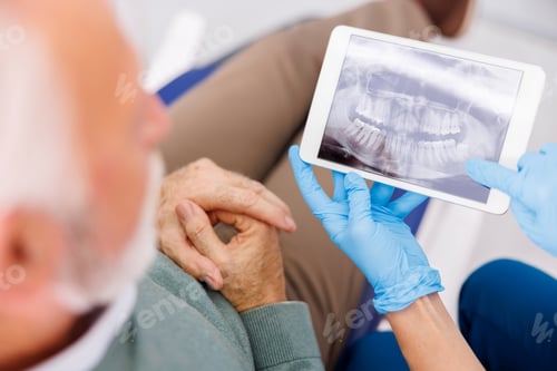 Preview: Doctor showing jaw x-ray to senior male patient at dentist office