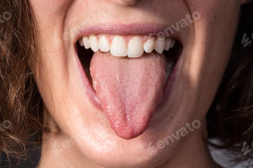Preview: Girl on a check visit to detect candidiasis on tongue