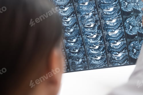 Preview: orthopedic doctor reviews closely patient X-ray films MRI scans close up shot.