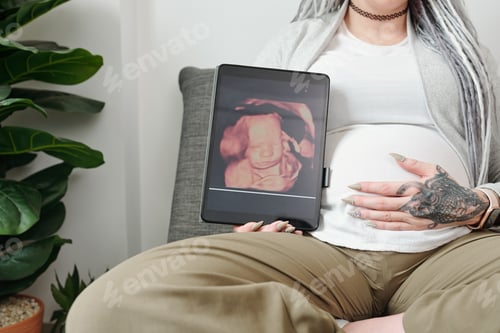 Preview: Pregnant woman showing ultrasound image