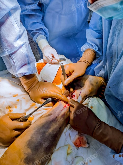 Preview: Surgical Team Performing Intense Medical Procedure in Hospital