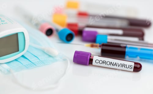 Preview: Laboratory sample of the novel Coronavirus