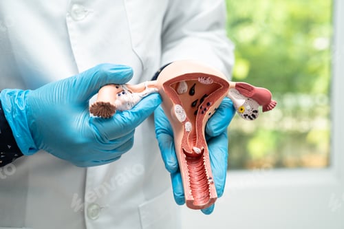 Preview: Uterus, doctor holding anatomy model for study diagnosis and treatment in hospital.