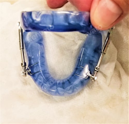 Preview: ORAL CARE! MANDIBULAR DEVICE FOR SLEEP APNEA!!