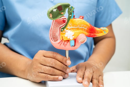 Preview: Pancreatitis, pancreatic cancer, Asian doctor with pancreas, gallbladder