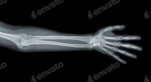 Preview: Hand x-ray view