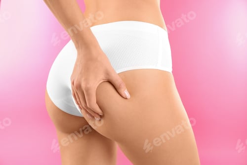 Preview: Closeup view of slim woman in underwear on color background. Cellulite problem concept