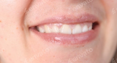 Preview: Close-up of a woman's face with a mustache over her upper lip.