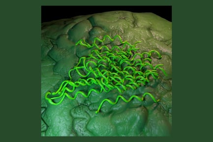 Preview: Treponema pallidum spirochetes